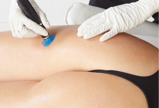 client_treatment_booty Female client receiving a Bootyfacial